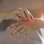 Photobiomodulation et microbiome cutané : piste de recherche émergente